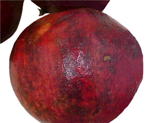 سوختگی پوست سوختگی پوست